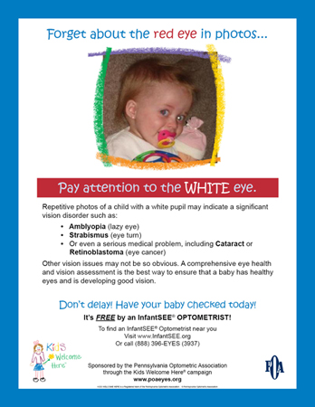 Images/PA/POA-WhitePupil-RetinoblastomaFlyerJPG.jpgWhite Pupil Flyer